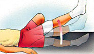 straight leg raises